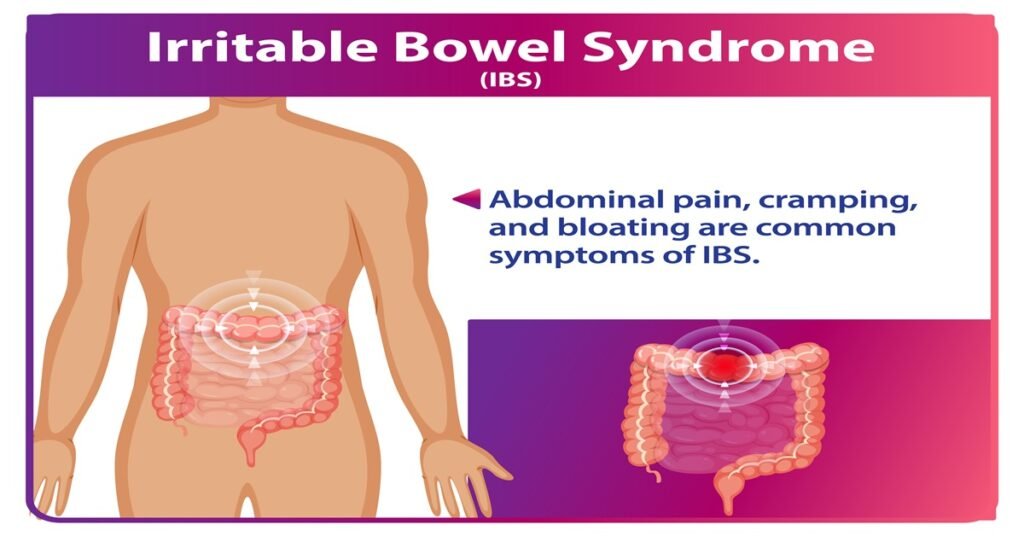 IBS